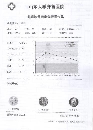 骨密度仪器上的打印机能够打印彩色报告单简易懂时刻掌握自己身体状况