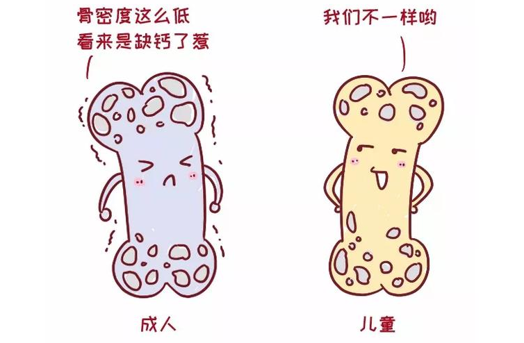 浙江金华6.25超声骨密度仪品牌厂家：低骨密度是骨质疏松症，对吧?